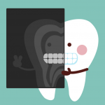 Dental X Rays